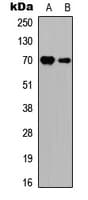 Polyclonal Rabbit anti-Human RPS6KB1 / P70S6K / S6K Antibody (Internal, IHC, IF, WB)