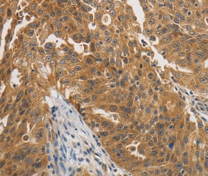 PTPN11 / SHP-2 / NS1 Antibody