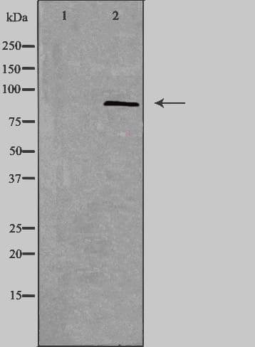 SMO / Smoothened Antibody