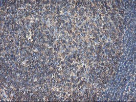 TUBAL3 Antibody (aa150-446, clone OTI2F6, Carrier-free)