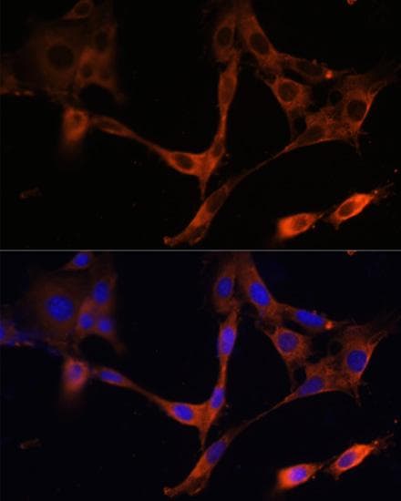 HMG-CoA Reductase / HMGCR Antibody
