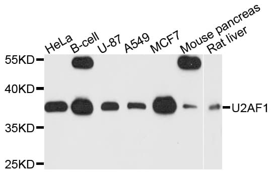 Polyclonal Rabbit anti-Human U2AF1 Antibody (IHC, WB)
