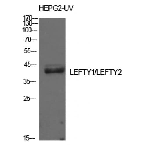 Polyclonal Rabbit anti-Human LEFTY1+2 Antibody (301-350 aa, C-terminal, WB)