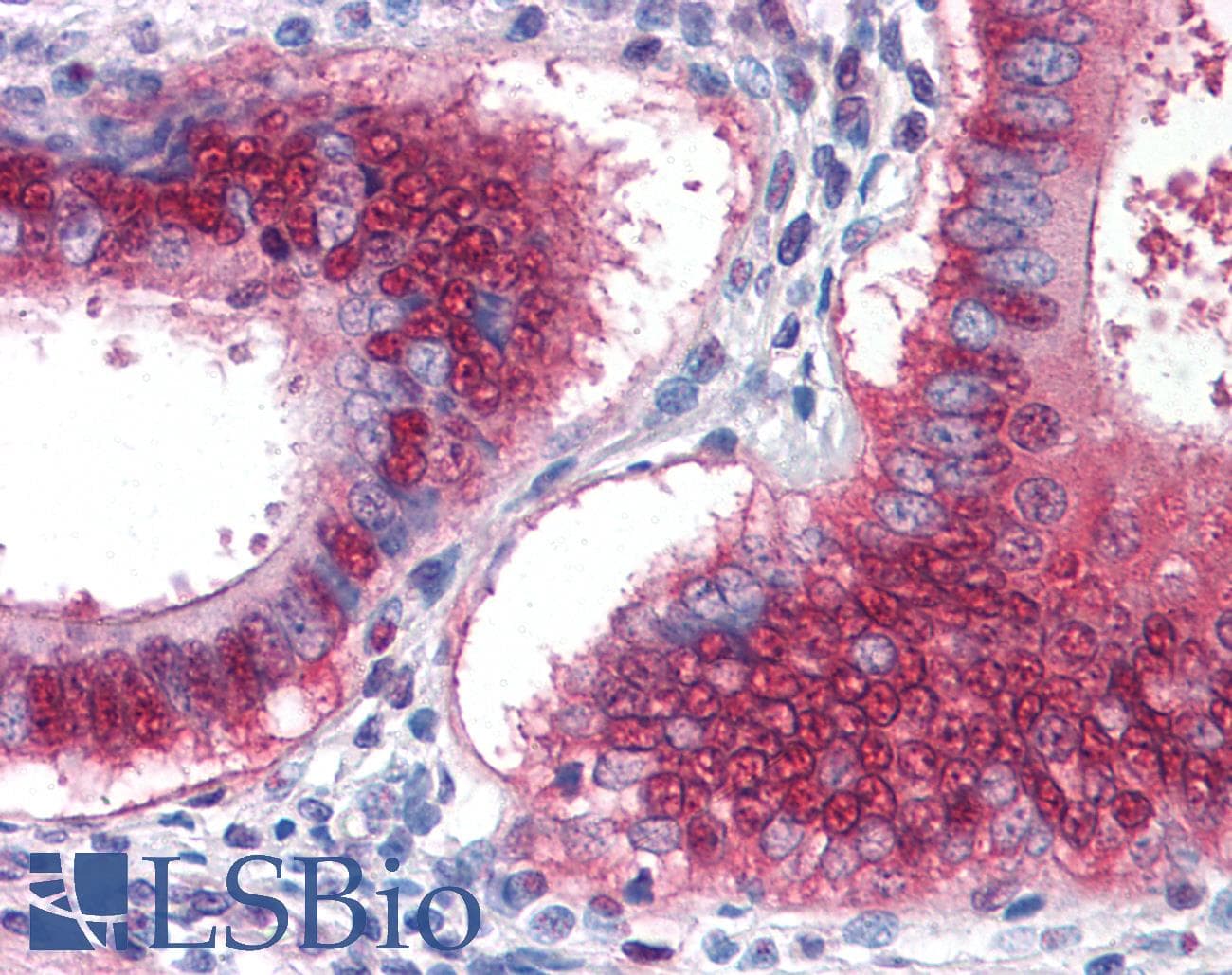IHC-plus™ YAP / YAP1 Antibody (clone 2H1)