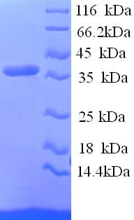 Human RCN1 / Reticulocalbin 1 Protein (Recombinant His)