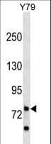 RHPN1 / RHOPHILIN Antibody (aa478-505)