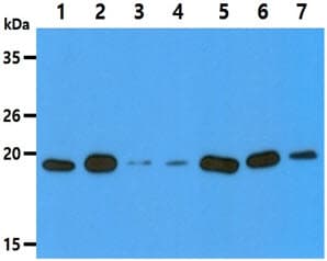 DUSP3 / VHR Antibody (clone AT9E6)
