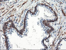 PFKP Antibody (clone OTI2E10)