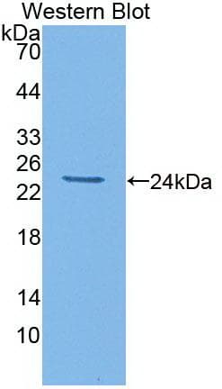 IL6 / Interleukin 6 Antibody (aa21-211, clone C8)