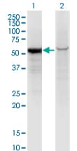 Monoclonal Mouse anti-Human GPI Antibody (clone 8B8, WB)