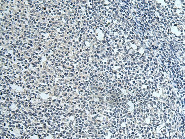 Polyclonal Rabbit anti-Human SLC35F6 Antibody (IHC)