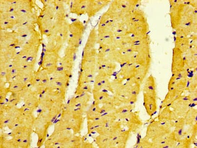 DMPK / DM Antibody