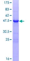 Human RAB25 Protein (Recombinant GST)