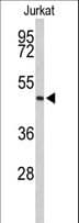 IHC-plus™ Polyclonal Rabbit anti-Human Acrosin Antibody (aa387-416, IHC, WB)