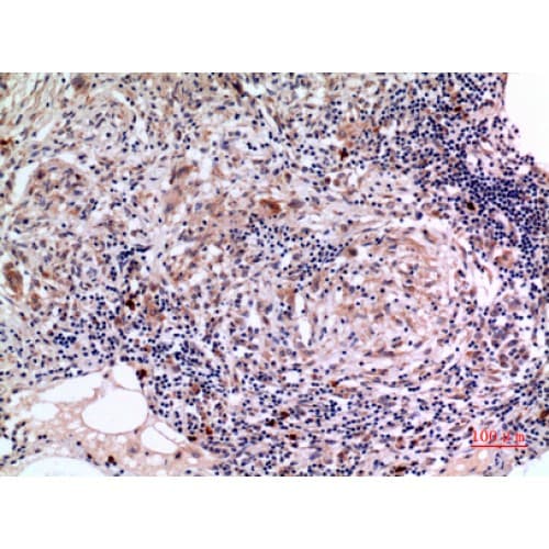 Polyclonal Rabbit anti-Human SERPINB3 Antibody (101-150 aa, Internal, IHC, WB)