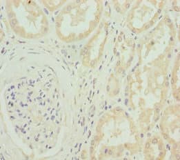 CACNB1 Antibody