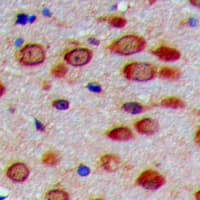 Polyclonal Rabbit anti-Human PEX11G Antibody (N-Terminus, IHC, WB)