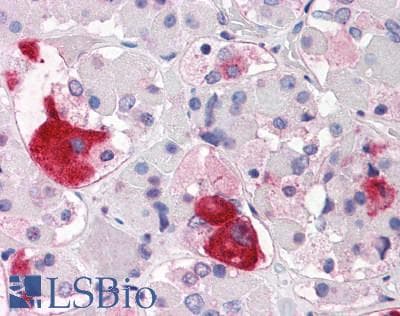 PathPlus™ CRHR2 / CRF2 Receptor Antibody (N-Terminus)