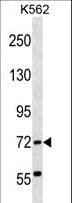 Polyclonal Rabbit anti-Human ABCF2 Antibody (aa3-32, WB)