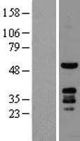 PKNOX1 / PREP1 Protein (Over-Expression Lysate Myc-DDK (Flag))