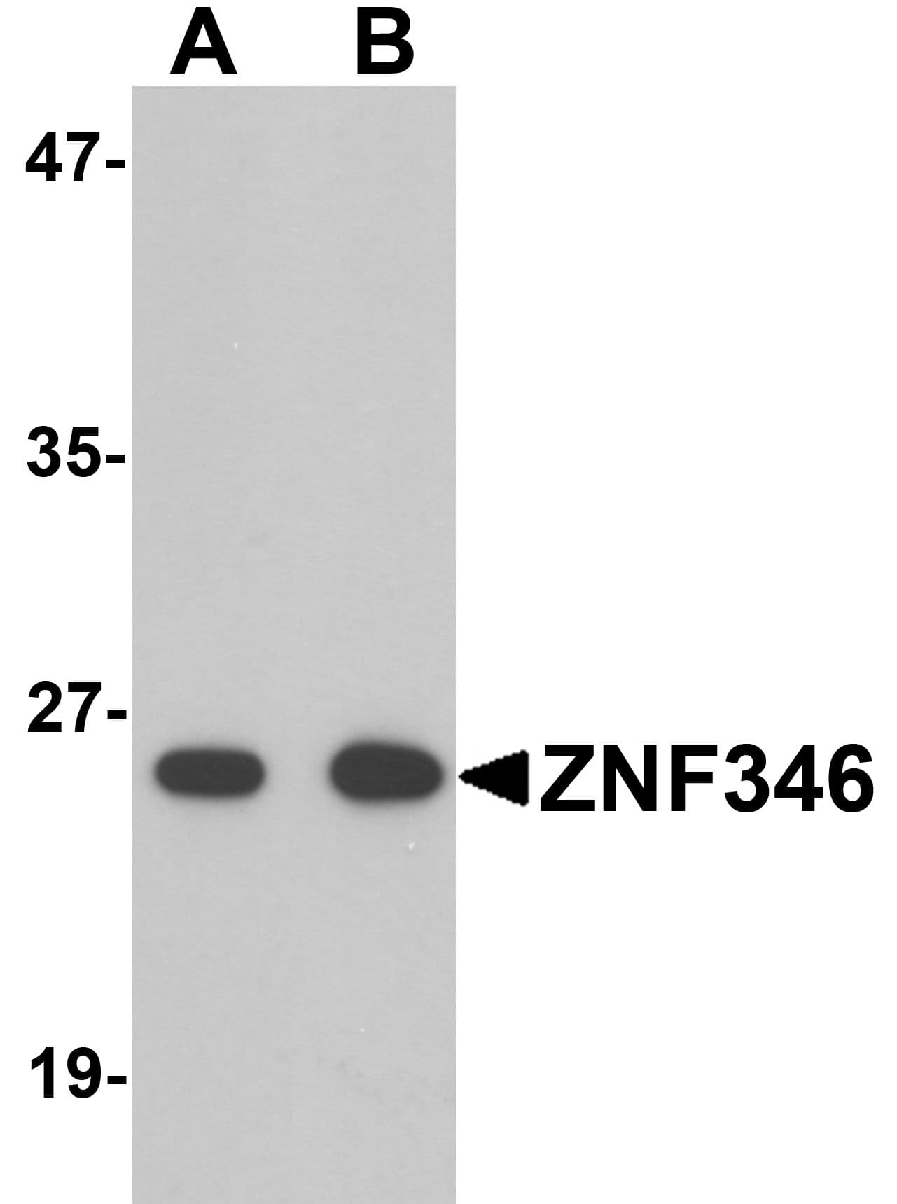 IHC-plus™ Polyclonal Rabbit anti-Human ZNF346 Antibody (IHC, WB)