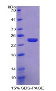 Human CNTNAP4 / CASPR4 Protein (Recombinant His-T7)