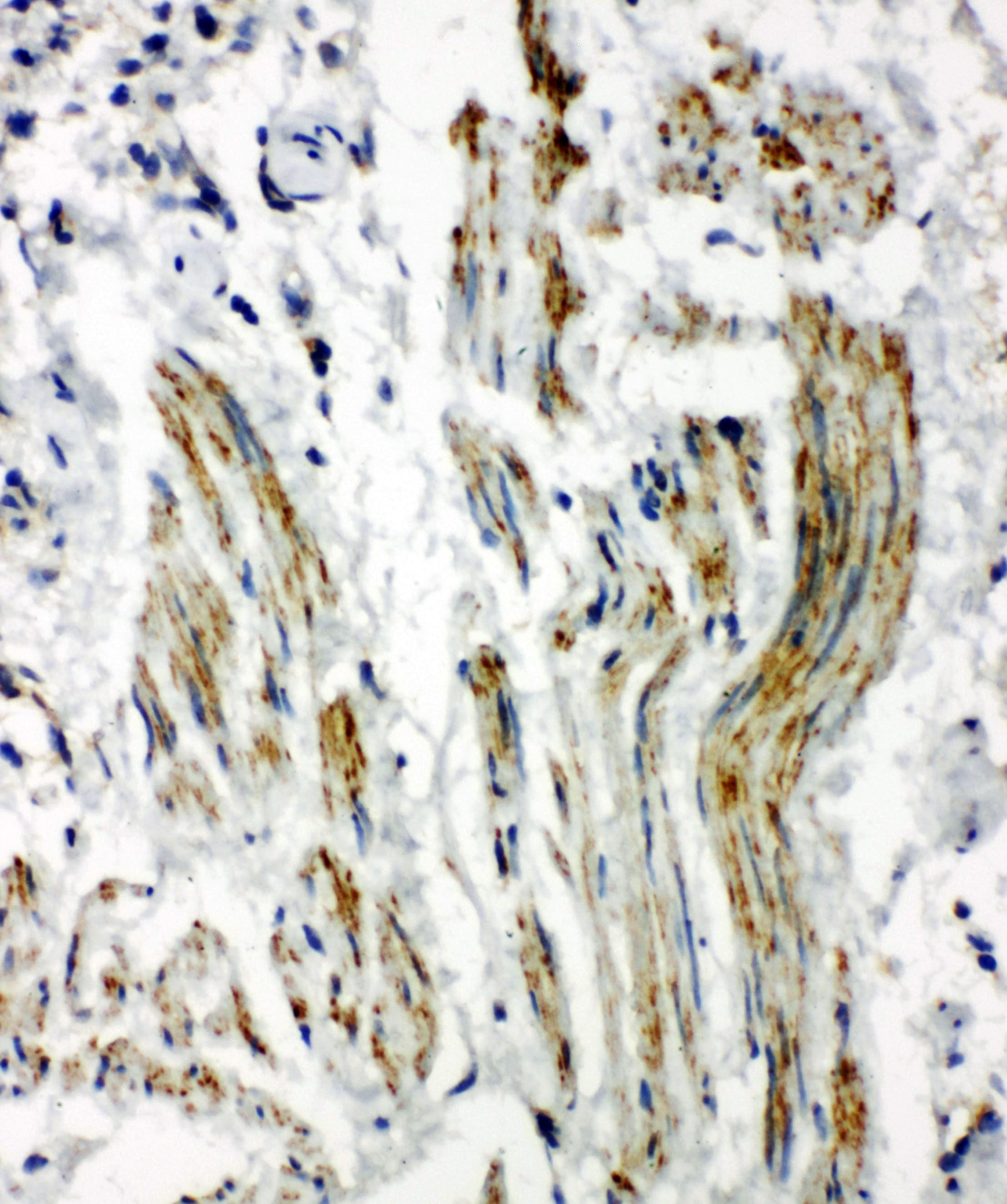 Polyclonal Rabbit anti-Human CAV2 / Caveolin 2 Antibody (aa1-17, IHC, WB)