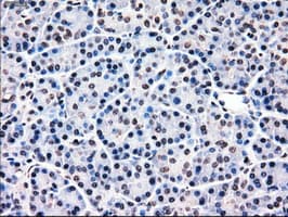 Monoclonal Mouse anti-Human MRI1 Antibody (clone OTI6G9, IHC, IF, WB)