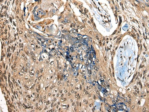 Polyclonal Rabbit anti-Human CAMKK1 Antibody (IHC, WB)