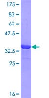 Human OVGP1 / Oviductin Protein (Recombinant GST, N-terminus)