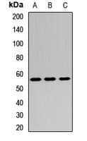 GSR / Glutathione Reductase Antibody