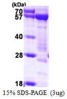 Human SNTA1 / Syntrophin Alpha 1 Protein (Recombinant His)