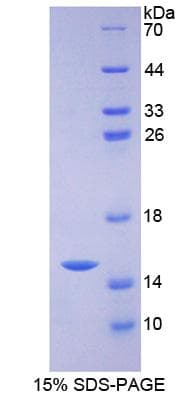 Mouse ZNT5 / SLC30A5 Protein (Recombinant His-S)