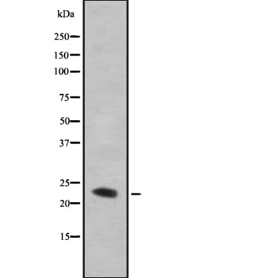 TMBIM4 / GAAP Antibody