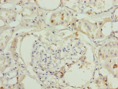 ILVBL Antibody