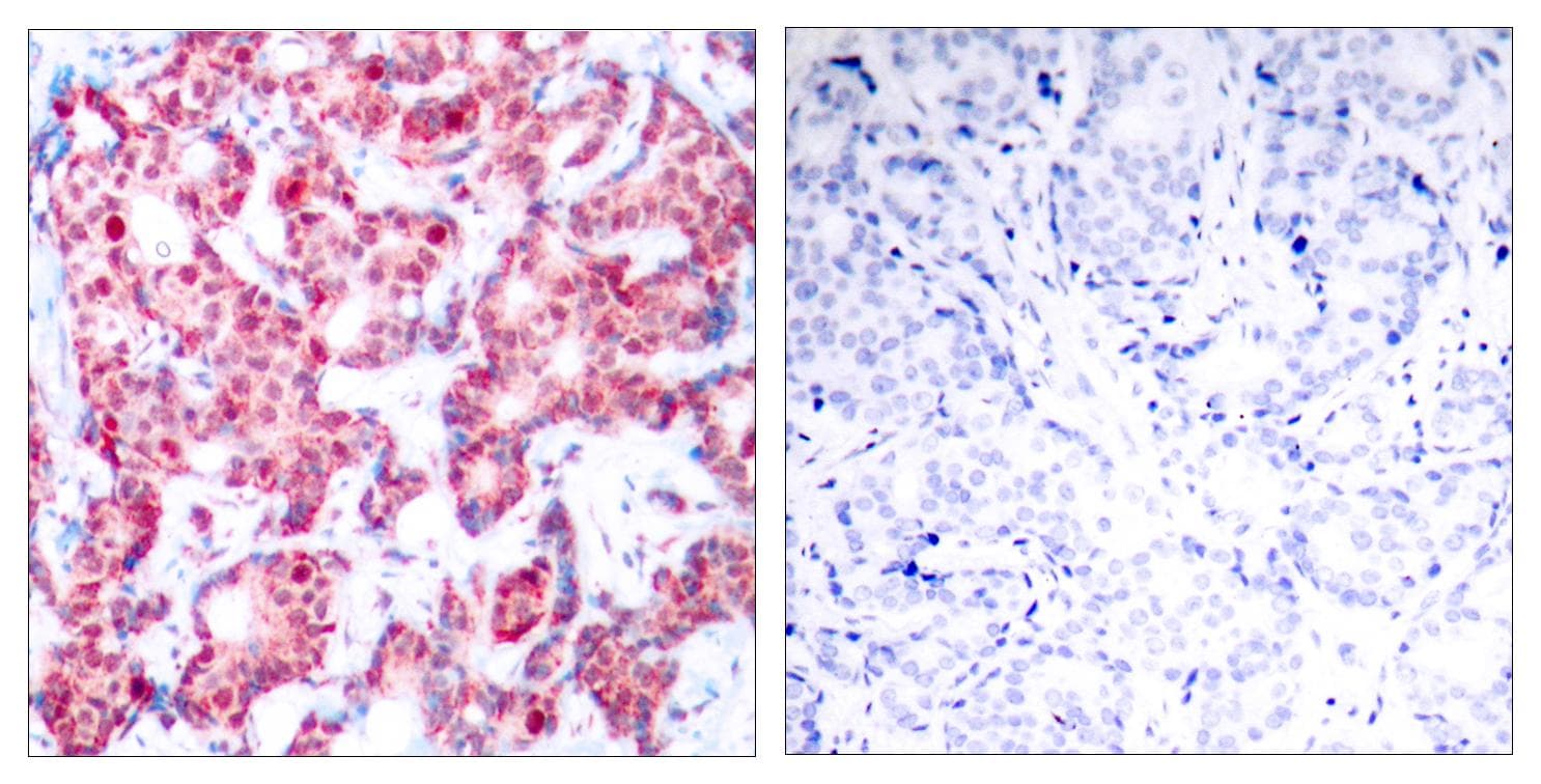 Polyclonal Rabbit anti-Human GATA1 Antibody (phospho-Ser142, IHC, WB)