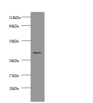 CKM / Creatine Kinase MM Antibody (HRP)