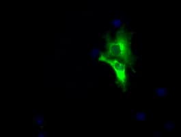 LIPG / Endothelial Lipase Antibody (clone OTI9F2, Carrier-free)