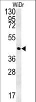Polyclonal Rabbit anti-Human CCNYL1 Antibody (aa41-70, IHC, WB)