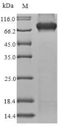Human MYL3 Protein (Recombinant GST, N-terminus)