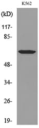 Polyclonal Rabbit anti-Human HPSE / Heparanase Antibody (WB)