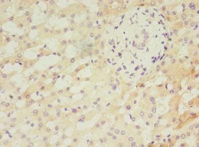 ANKMY2 Antibody