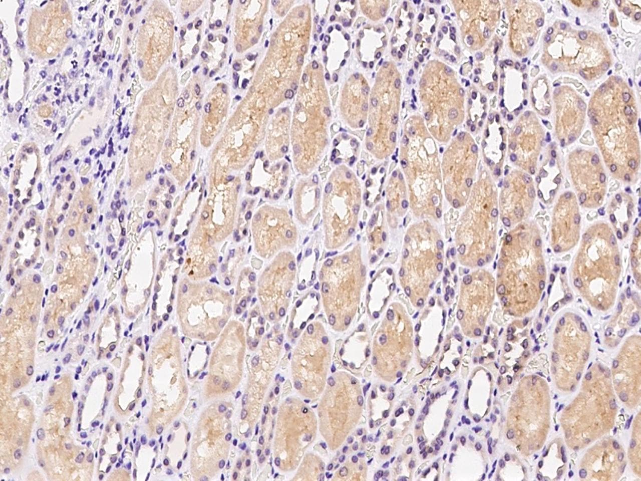 Polyclonal Rabbit anti-Human HDHD2 Antibody (IHC, WB)