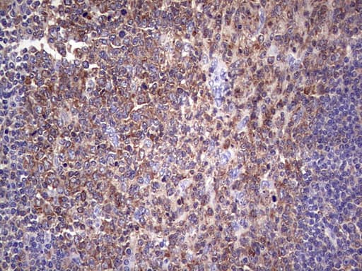 Monoclonal Mouse anti-Human PKM2 Antibody (clone 1F12, IHC, WB)