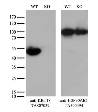 KRT18 / CK18 / Cytokeratin 18 Antibody (aa69-372, clone OTI10H8)