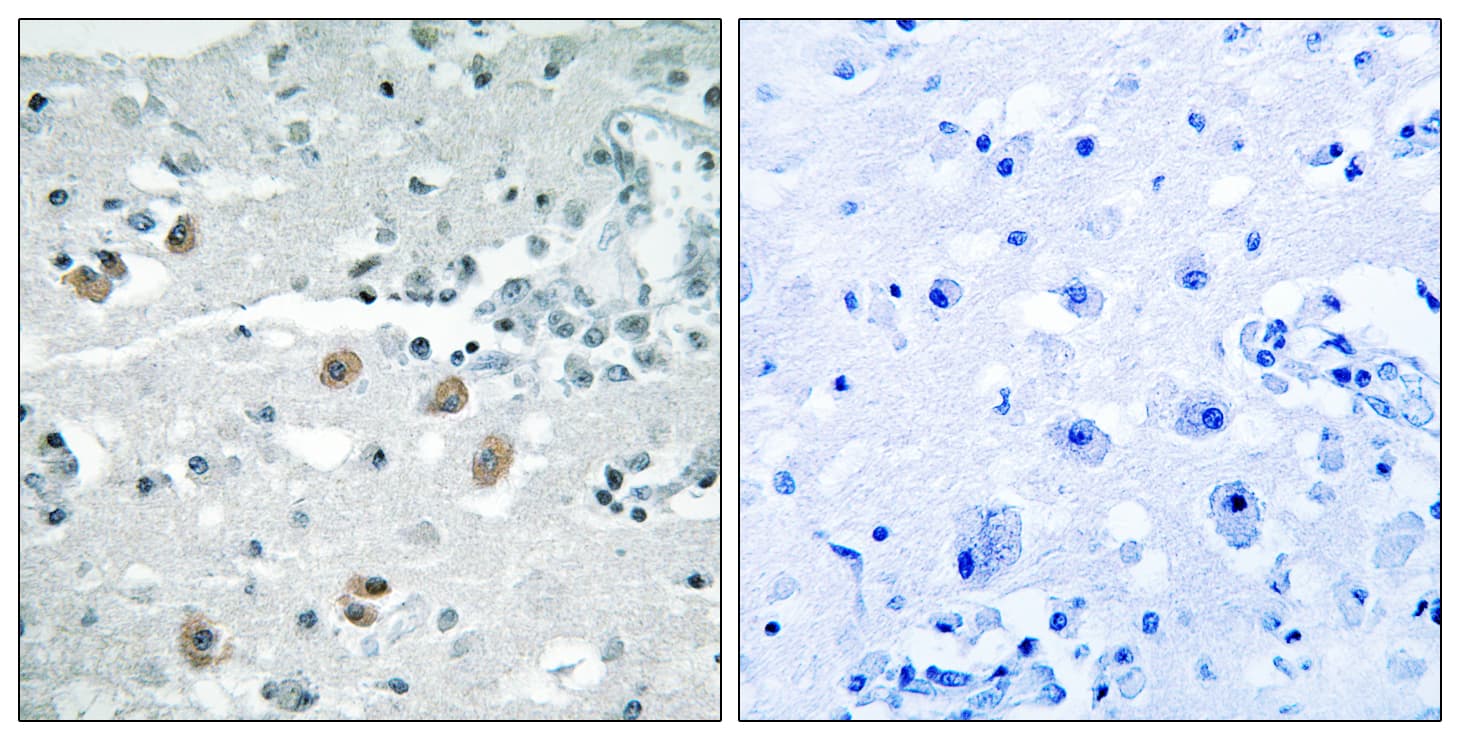 Polyclonal Rabbit anti-Human PLA2G4D Antibody (aa531-580, IHC)