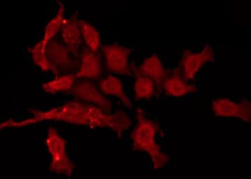 CAMKV Antibody