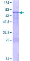 Human ZNF785 Protein (Recombinant GST)