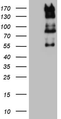 GLI / GLI1 Antibody (aa755-1106, clone OTI12D5)