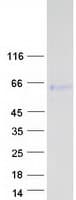 Human CLU / Clusterin Protein (Recombinant Myc-DDK (Flag))